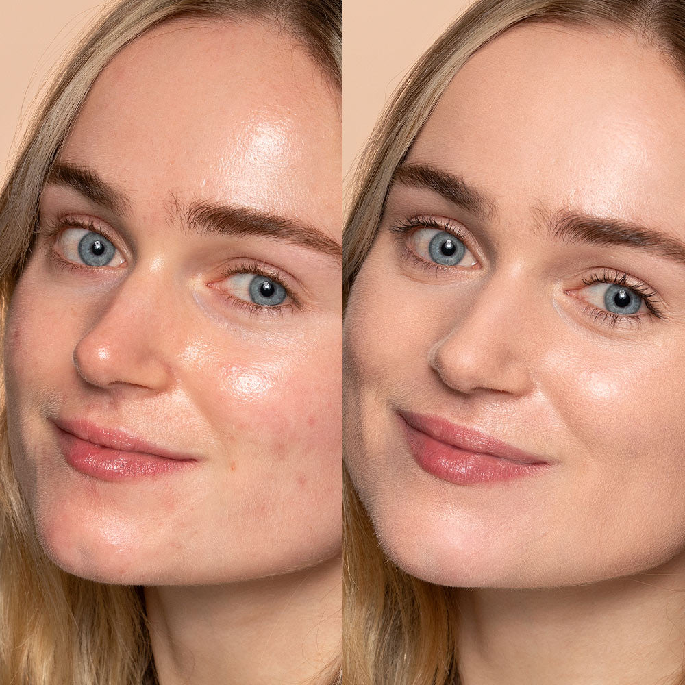 The Lip Reset Kit