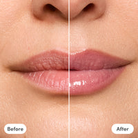 The Lip Reset Kit