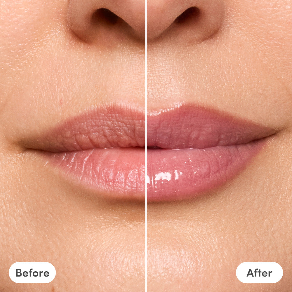 The Lip Reset Kit - Megan + Matilde