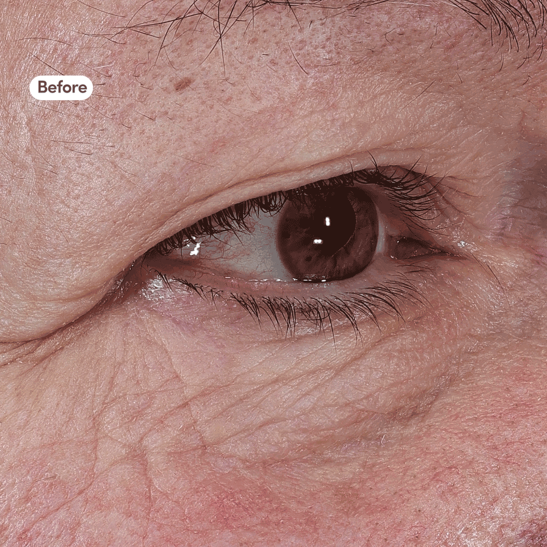 Take Back Time Eye Treatment